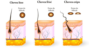Longueur de la lacewig Forme du follicule cheveux lisse crépus & frisés